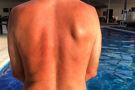 Brauner Radler-Rücken am Swimmingpool