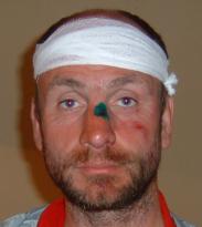 Christoph Gocke nach Überfall